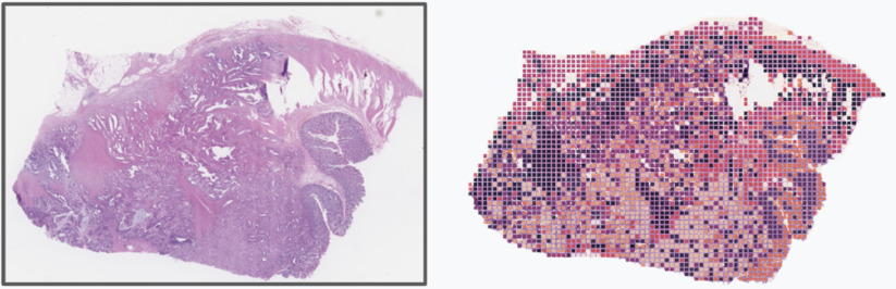 Representation k-means clustering of patch embeddings sampled across a whole
slide image