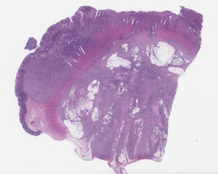 thumbnail image of whole slide image