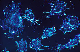 Células de câncer